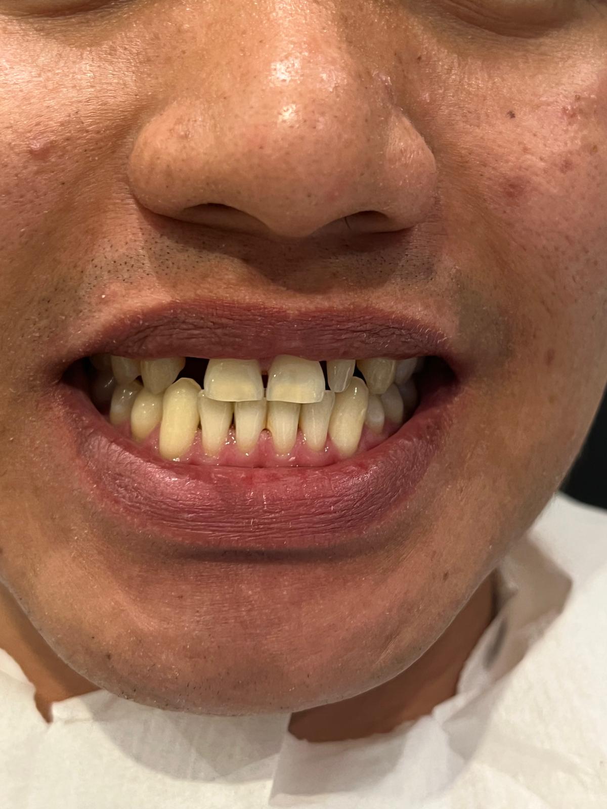 ECE Dental Patient Transformation